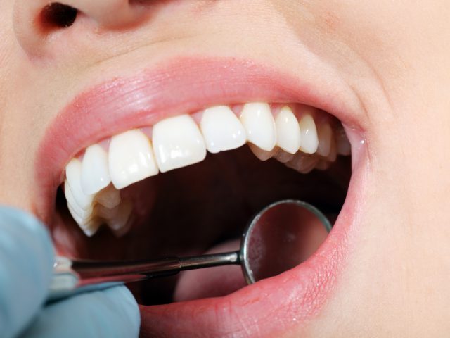 https://dentalhomecare.com.br/wp-content/uploads/2016/08/boca-640x480.jpg